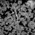 Urátový krystal v temném poli mikroskopu